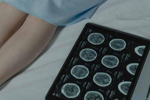 Dévoiler les Secrets du Cancer avec Nouvelles Innovations