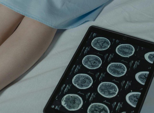 Dévoiler les Secrets du Cancer avec Nouvelles Innovations